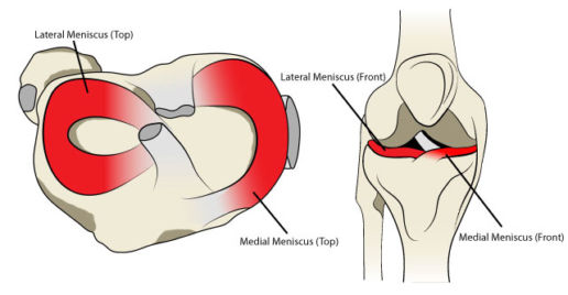 common wakeboard injuries - knee ligaments